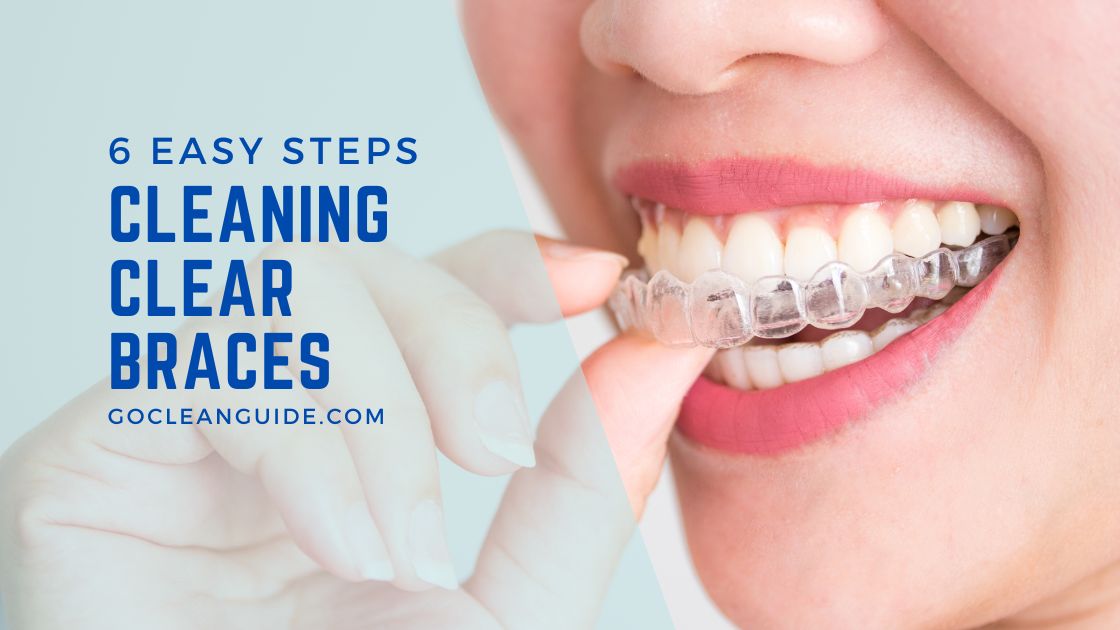 A Guide to Cleaning Clear Braces In 6 Easy Steps